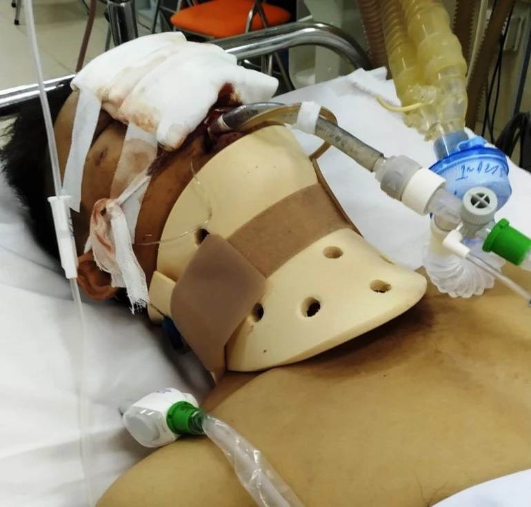 Em Sỹ bị tai nạn giao thông nguy kịch